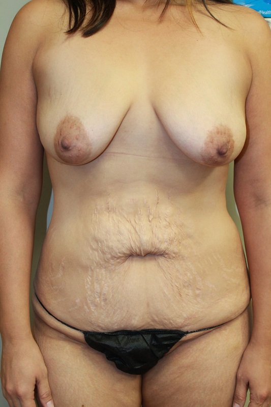Before image