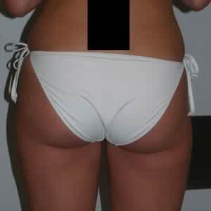 After image