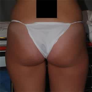 Before image