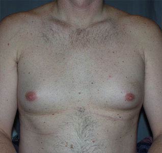 After image