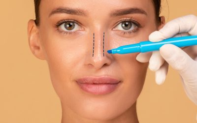 Can Cartilage Move After Rhinoplasty​?
